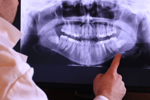 Best Broken Tooth Emergency  in Friona, TX