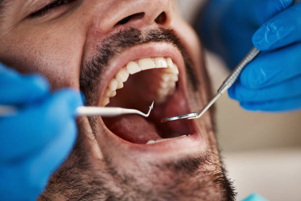 Best Tooth Pain Emergency Relief  in Friona, TX